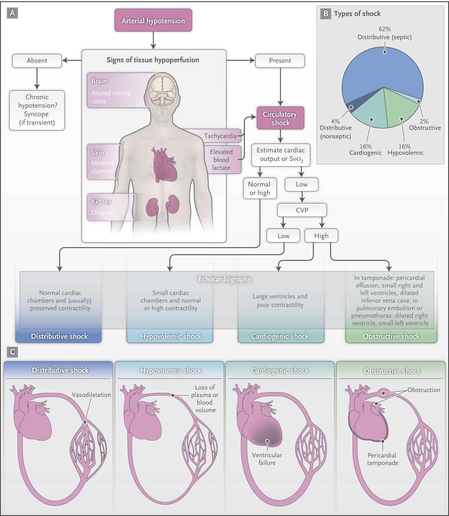 Initial Assessment of Shock States