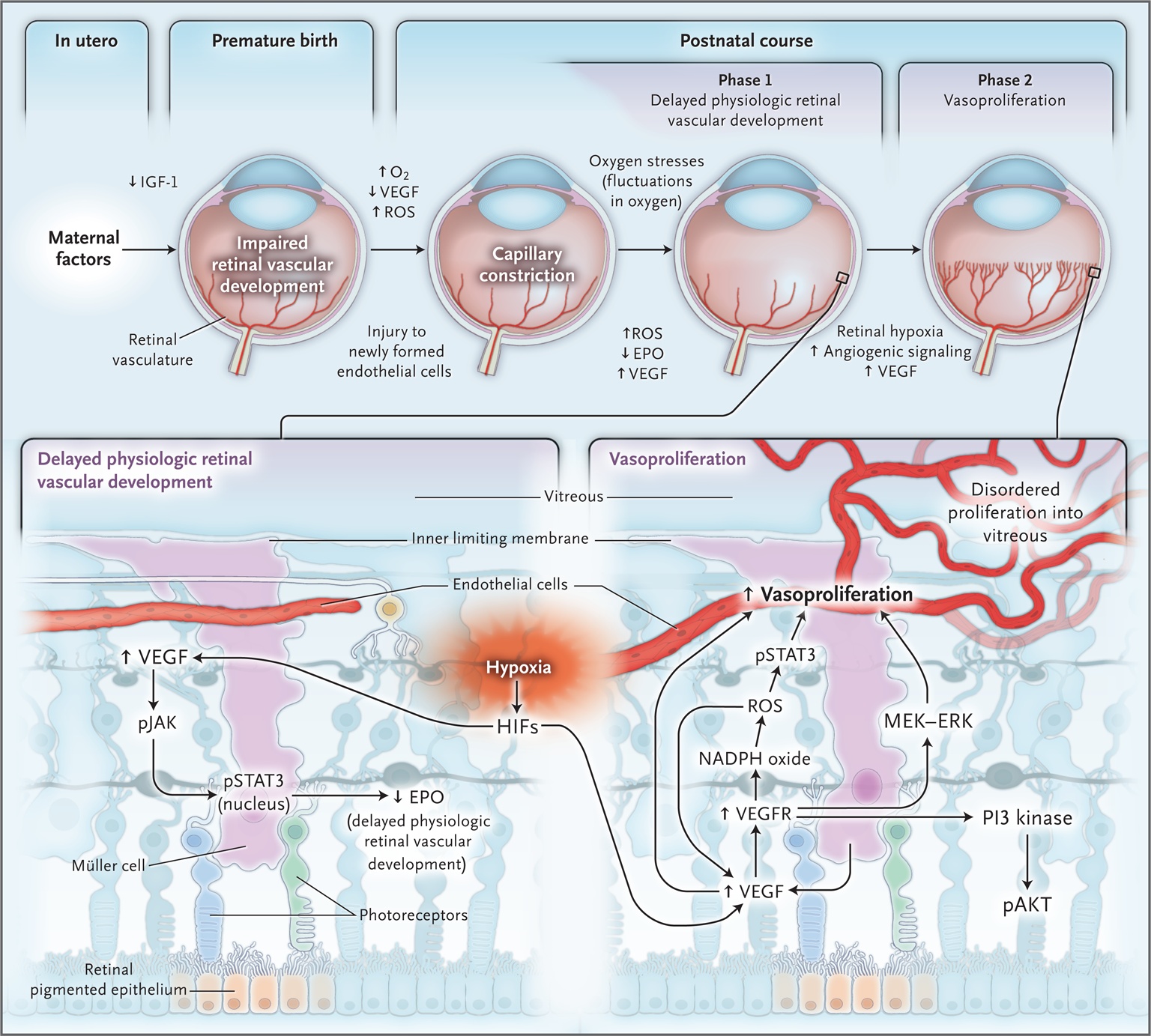 Revised Two-Phase Hypothesis of Retinopathy of Prematurity
